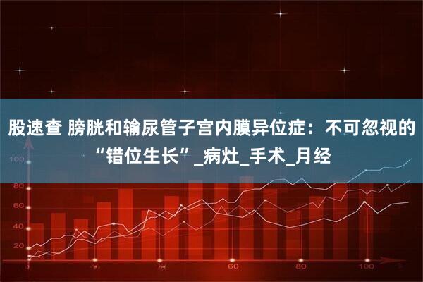 股速查 膀胱和输尿管子宫内膜异位症：不可忽视的“错位生长”_病灶_手术_月经